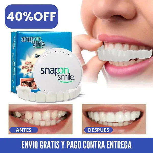 Carillas Plasticas Snapon Smile™